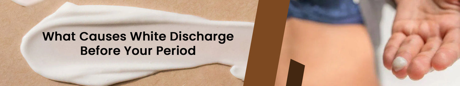What Causes White Discharge Before Your Period?