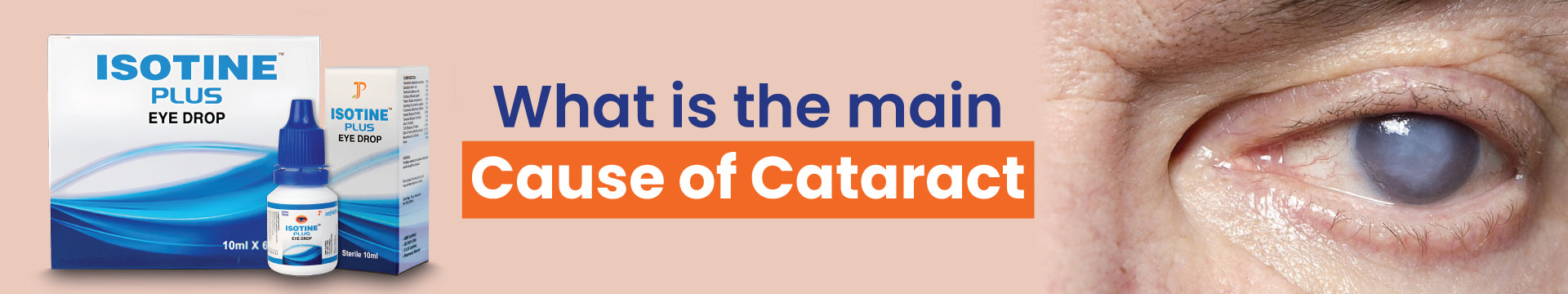 What is the main cause of Cataract?