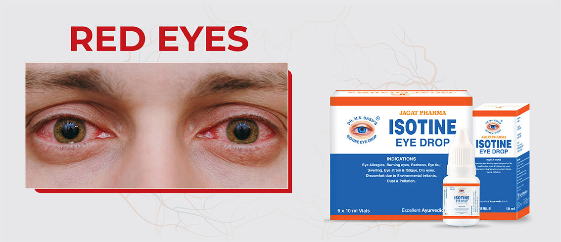 Red Eyes: Know More About It and The Treatment