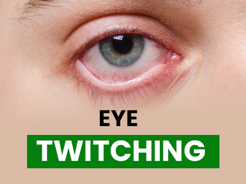 Eye Twitching Its Causes & Remedies