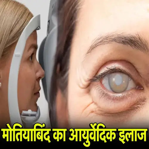 Cataract Awareness Month 2025: आंखों में दिख रहे हैं ये संकेत, कही मोतियाबिंद की शुरुआत तो नहीं? जानें डॉक्टर से