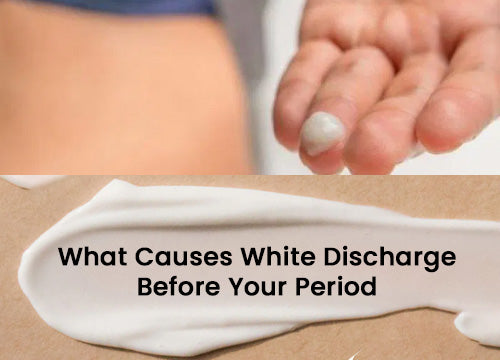 What Causes White Discharge Before Your Period?